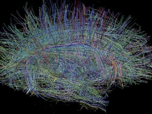 Portrait or artwork for Episode 68 – Moran Cerf Ph.D. – The Razor’s Edge of Neuroscience